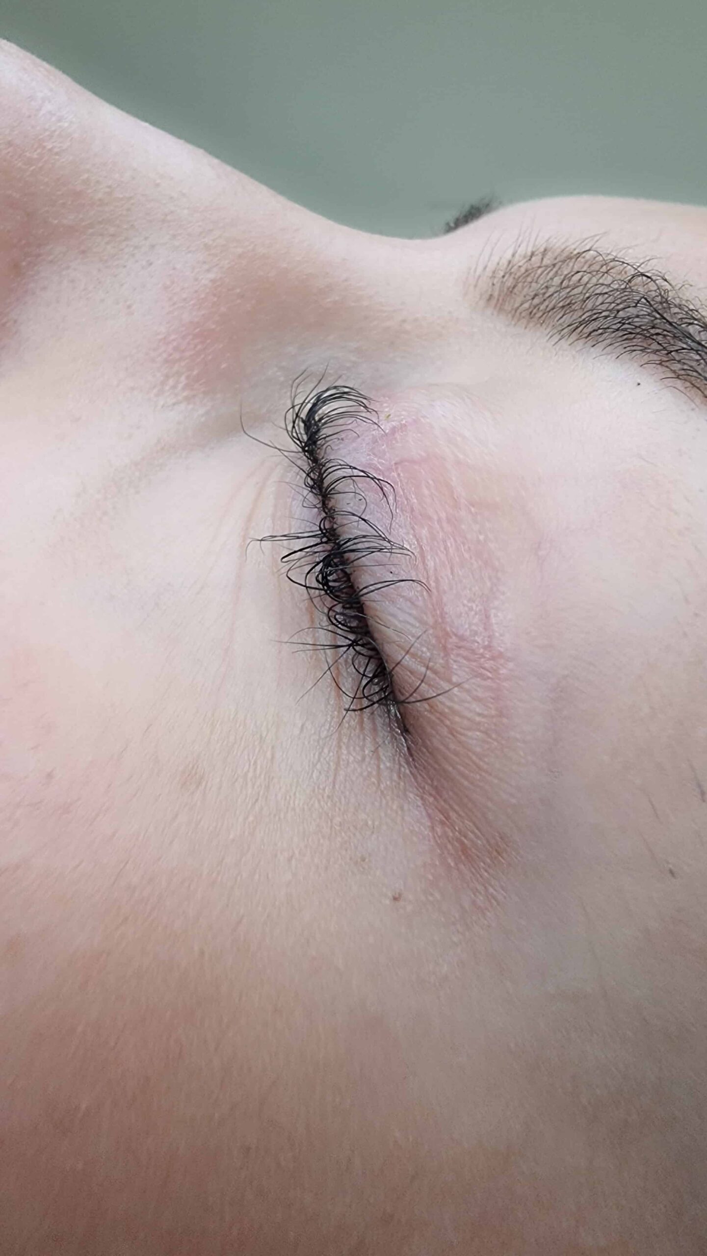 Ciglia bruciate da laminazione ciglia sbagliata