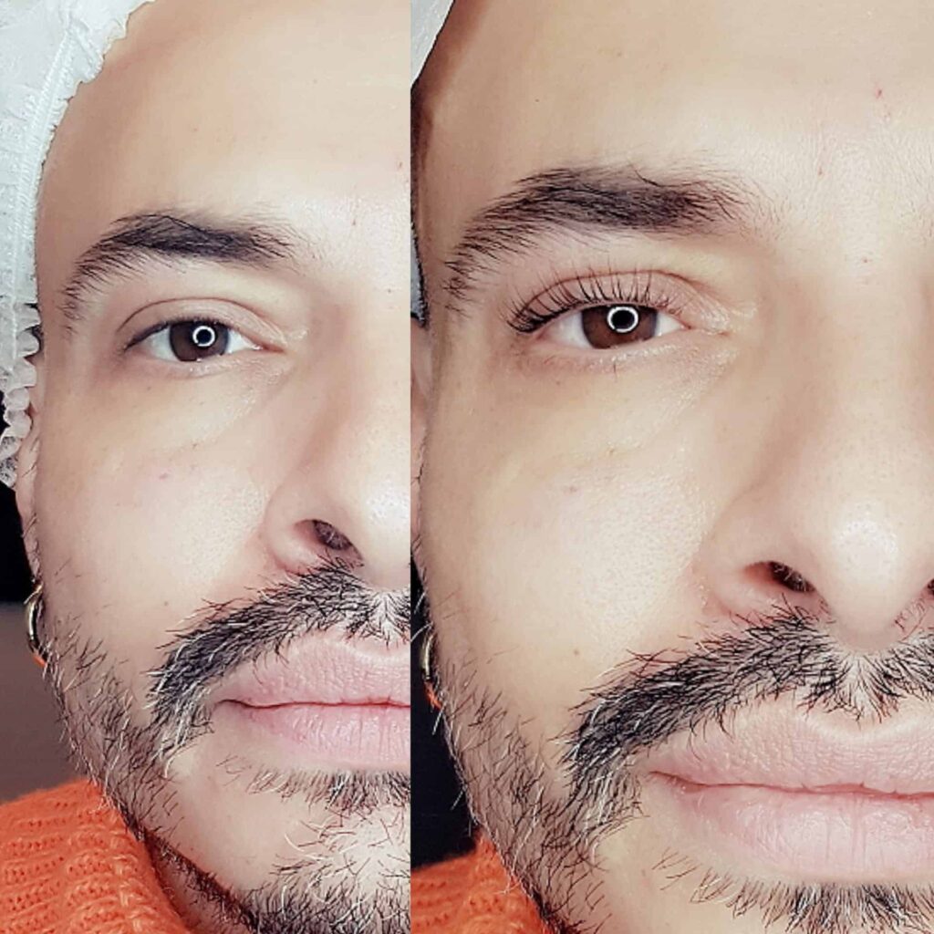 Prima e dopo, laminazione ciglia uomo.