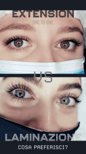 Laminazione-vs-extension