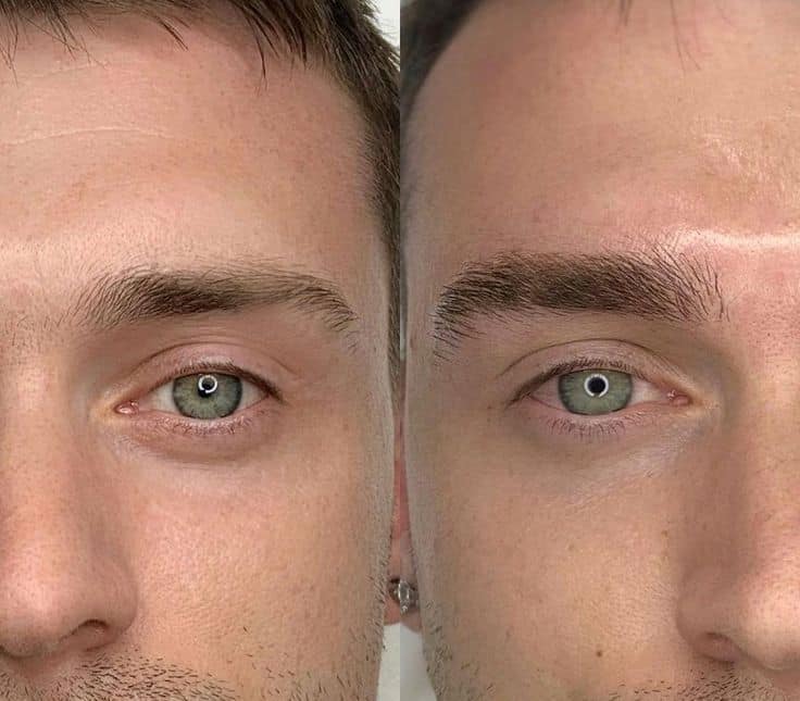 laminazione sopracciglia uomo prima e dopo