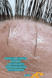 ciglia fuori rima ciglia ciliare, laminazione ciglia, ciglia fuori posizione
