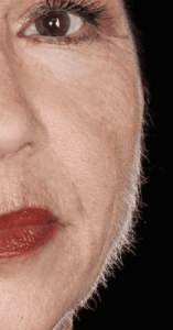 peluria viso, lanugine, ciglia e sopracciglia